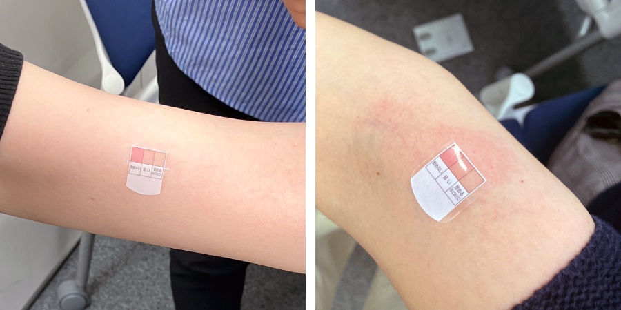 ＜左：「アルコールに強い」という判定になった参加者、皮膚の色に変化はありません　右：「お酒が飲めない」となった参加者の皮膚は赤くなりました＞